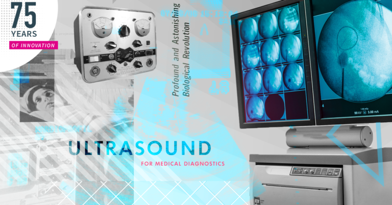 SRI 75 Ultrasound