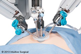 telerobotic surgery